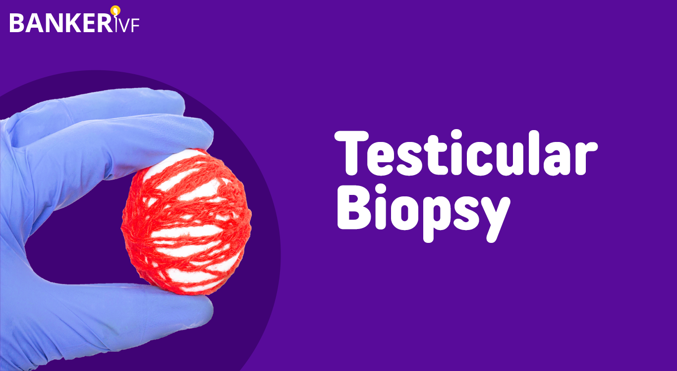 Testicular Biopsy Objective Process Risks And Recovery