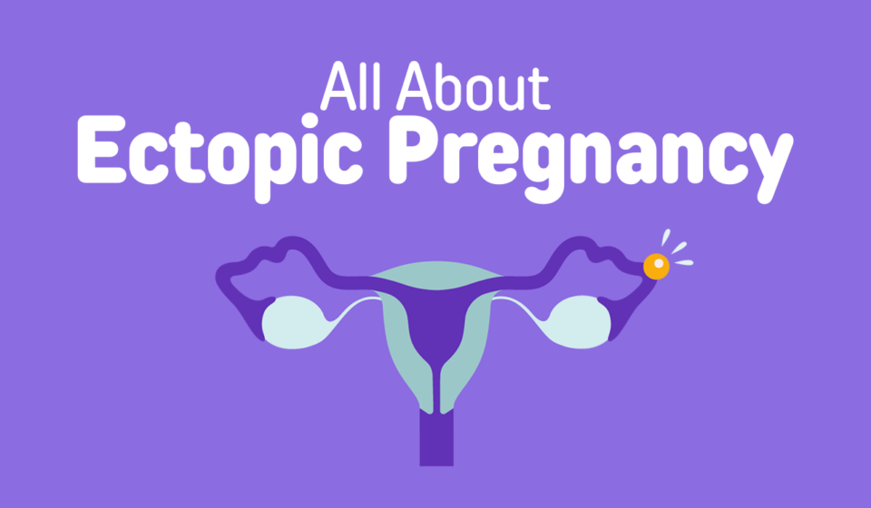 What is Ectopic Pregency