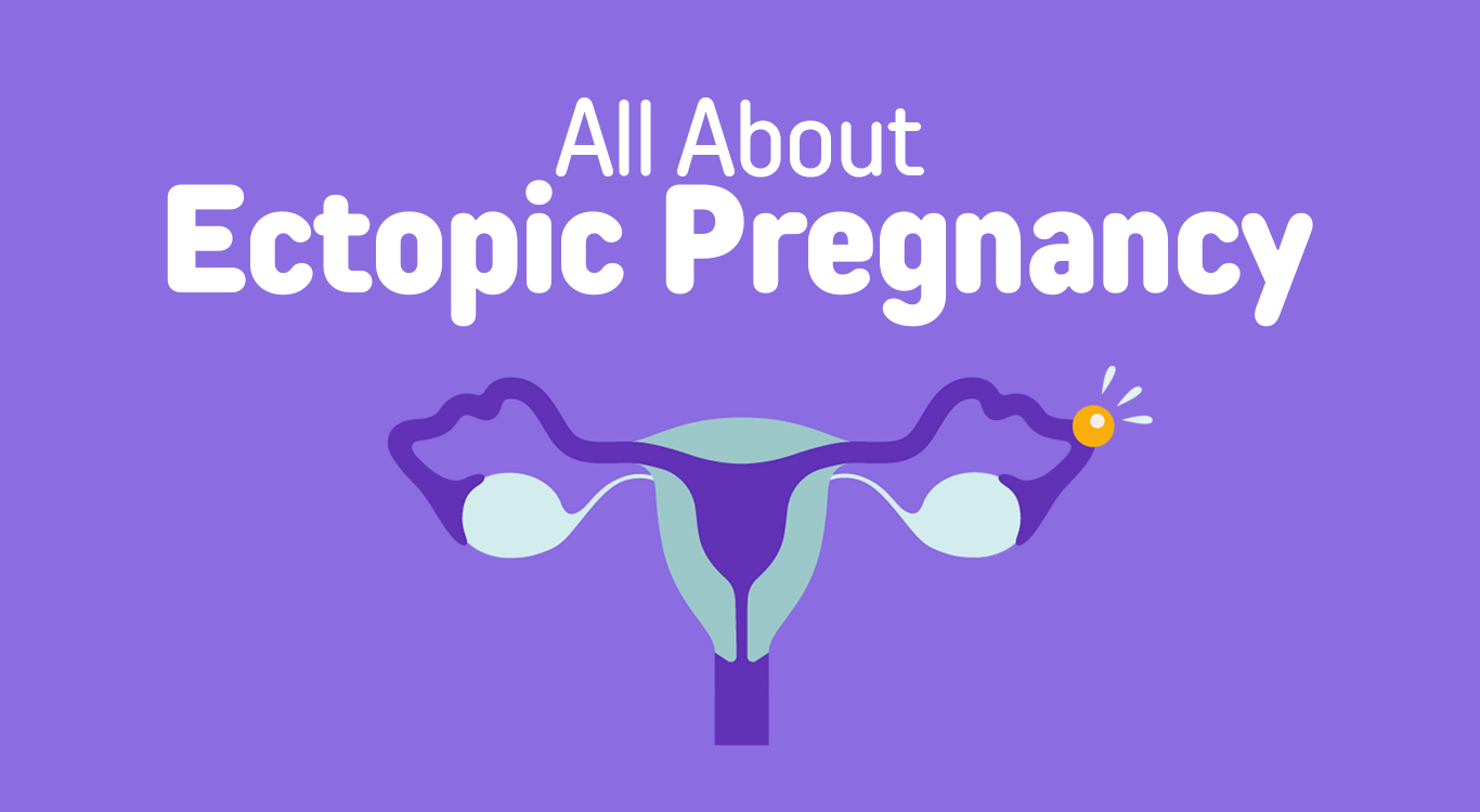 Ectopic Pregnancy – Symptoms, Causes, and Effective Treatment Options