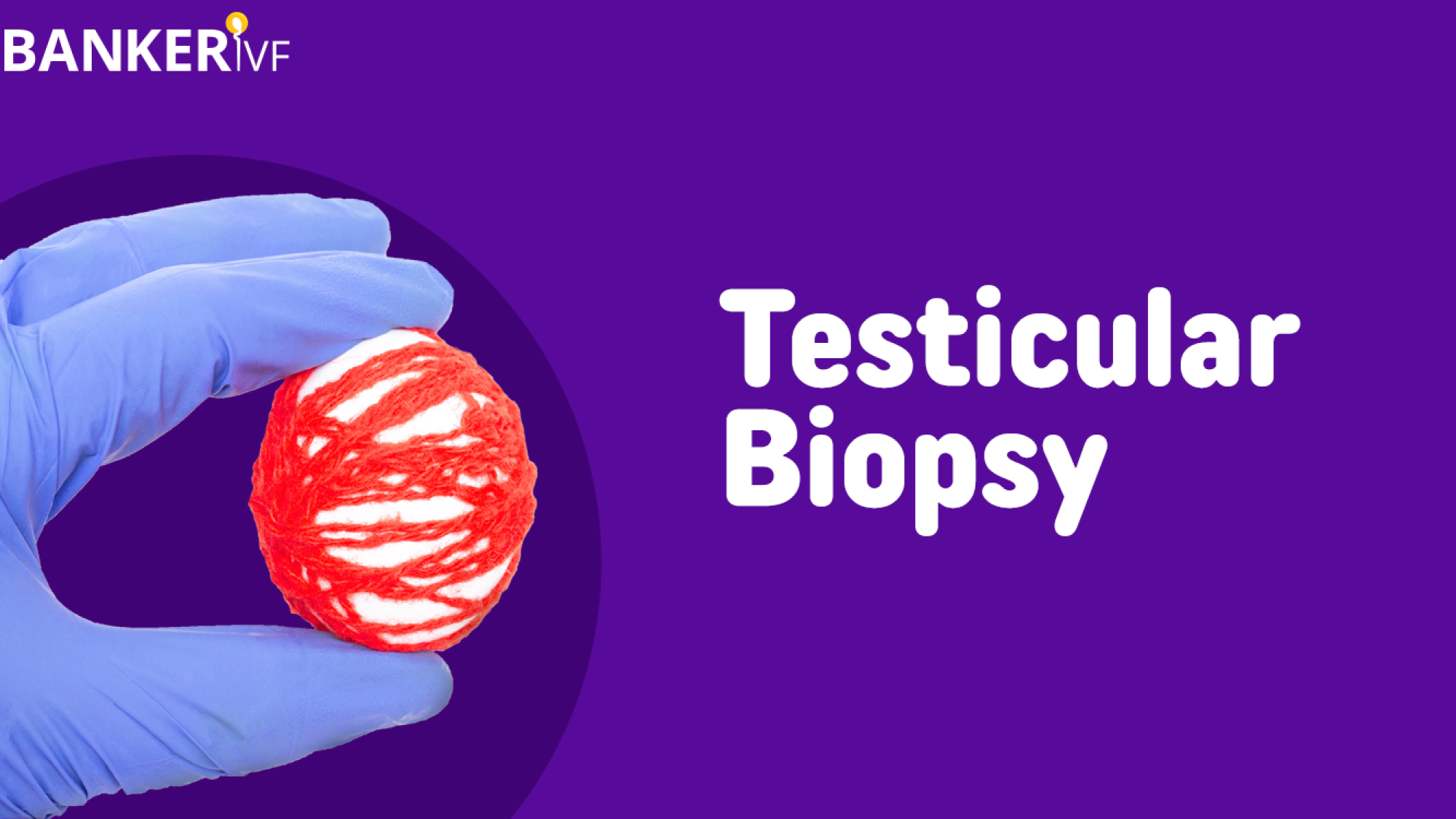 Testicular-Biopsy-Banker-IVF