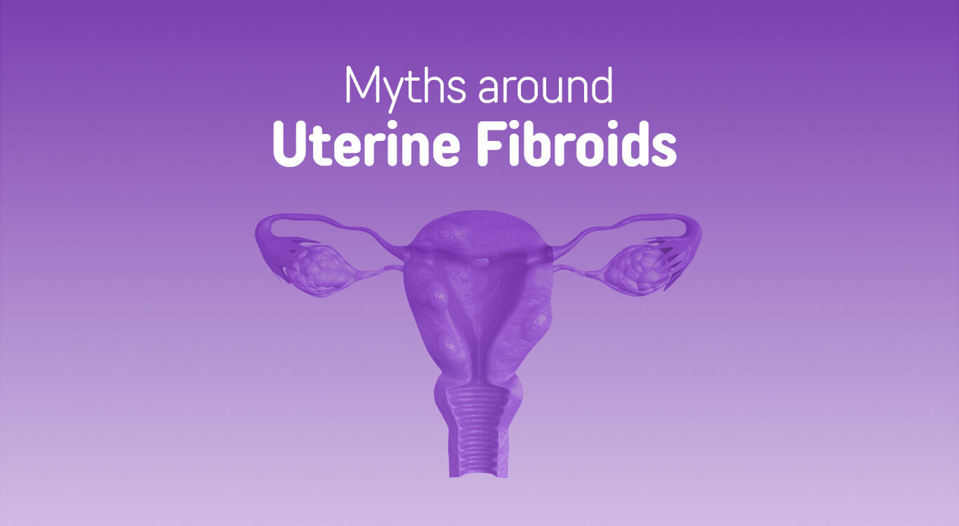 Uterine Fibroids Myths Vs Facts Banker Ivf