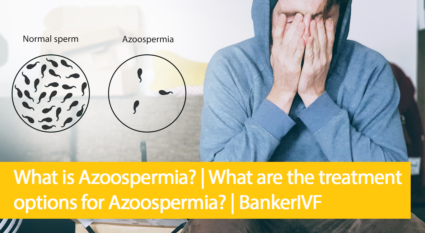 Azoospermia Causes, Symptoms, Diagnosis, Treatment, and Prevention