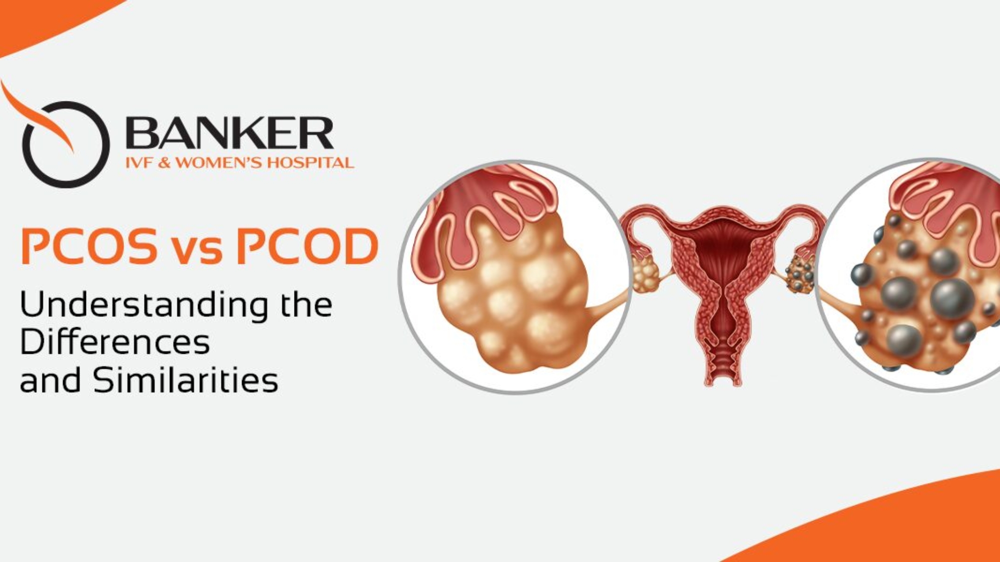 PCOS vs PCOD
